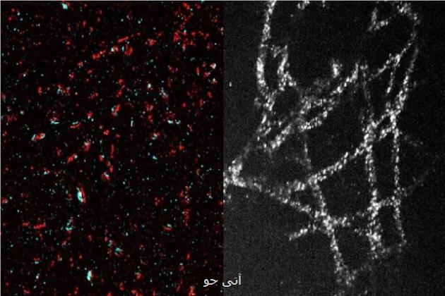 تصویربرداری ارزان از بدن در مقیاس نانو امکان پذیر شد